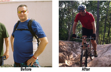 Anu client Jeff before-after pic